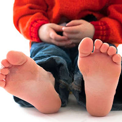 Obesity & Overweight can lead to Flat Feet