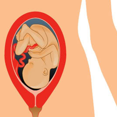 Signs of Labour During the Late Stage of Pregnancy